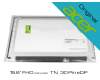 Acer KL15605031 original TN Display (1920x1080) matt 60Hz